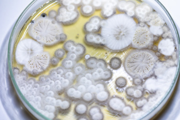 Colony characteristic of Actinomyces, Bacteria, yeast and Mold on selective media from soil samples for study in laboratory microbiology.