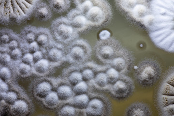 Colony characteristic of Actinomyces, Bacteria, yeast and Mold on selective media from soil samples for study in laboratory microbiology.