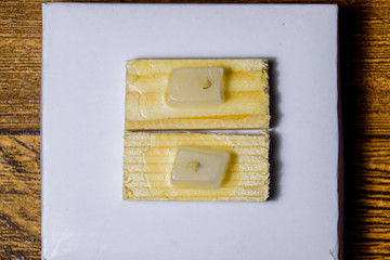 Paraffin blocks with cancer samples, samples for histological examination of the tumor.