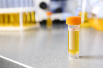 Container with urine sample on table in laboratory, space for text. Medical analysis