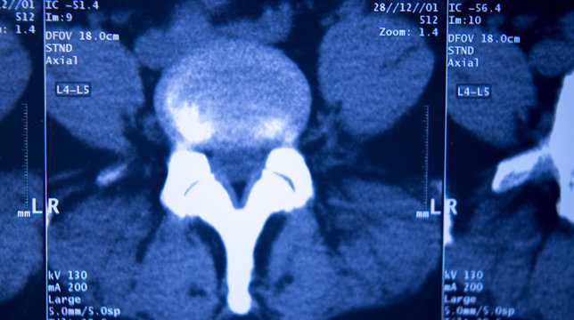 Medical hips spine pelvis MRI scan