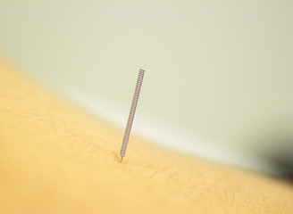 Dry needling EPI needle