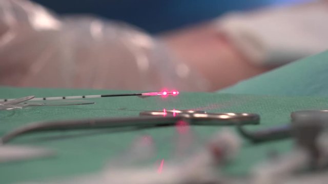 Endovenous laser ablation (EVLA) is a commonly used and very effective minimally invasive therapy to manage leg varicosities.