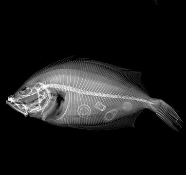Radiografía en blanco y negro de un pez visto lateralmente con basura dentro.