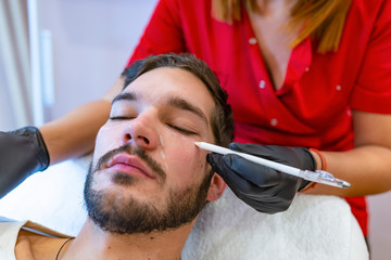 Close-up of doctor's hand drawing correction lines on good looking man's face. Procedure before plastic surgery.