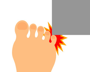 なぜ足の小指はぶつかるのか？