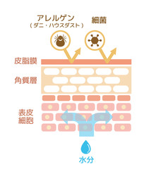 皮膚断面図 健康な皮膚とダメージを受けた皮膚の比較図 Wall Mural Barks