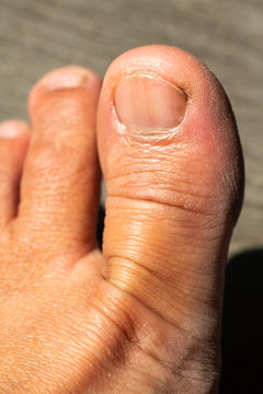 Women's dry and dirty skin big toe on wood background, Close up & Macro shot, Asian Body skin part, Healthcare concept