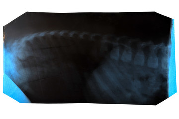 spine x-ray on white