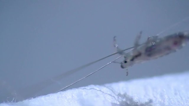 Kopflaus (Pediculus humanus capitis) head louse