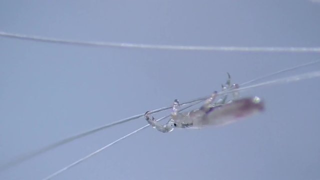 Kopflaus (Pediculus humanus capitis) head louse