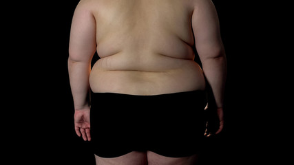 Obese male on black background, excess weight problem, overeating, health care