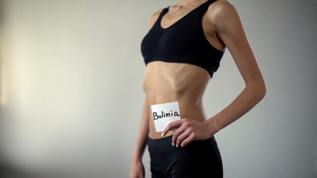 Skinny girl holding bulimia note, exhausted body needs help, eating disorder