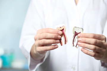 Dentist holding model of tooth on blurred background, closeup