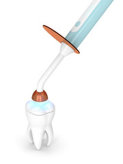 3d render of dental polymerization lamp and light cured onlay