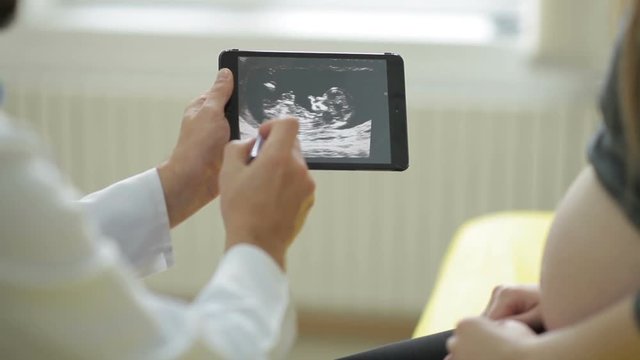 Doctor shows a picture of an ultrasound on a tablet to a pregnant woman