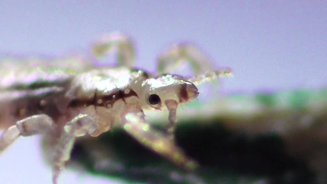 Kopflaus (Pediculus humanus capitis), head lice