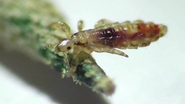 Kopflaus (Pediculus humanus capitis), head lice