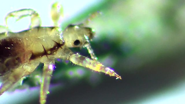 Kopflaus (Pediculus humanus capitis), head lice