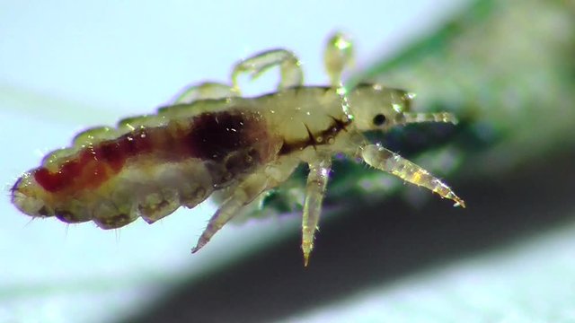 Kopflaus (Pediculus humanus capitis), head lice