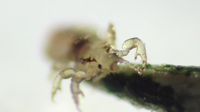 Kopflaus (Pediculus humanus capitis), head lice