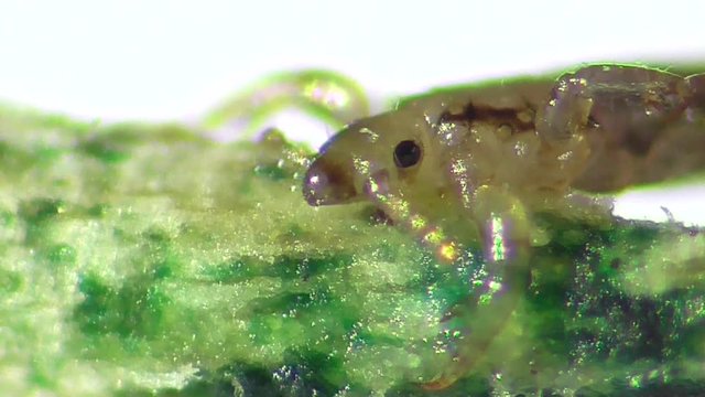 Kopflaus (Pediculus humanus capitis), head lice