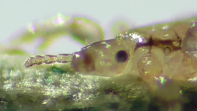 Kopflaus (Pediculus humanus capitis), head lice