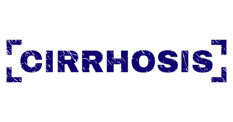 CIRRHOSIS title seal print with grunge effect. Text label is placed between corners. Blue vector rubber print of CIRRHOSIS with scratched texture.