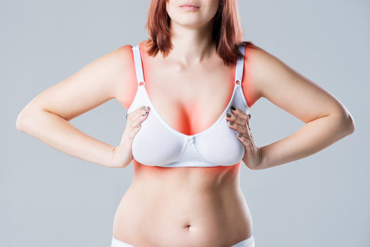 Woman with irritated skin under bra, irritation on the body from underwear on gray background
