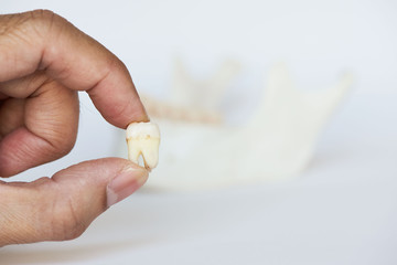 Dentist finger holding an extracted wisdom tooth