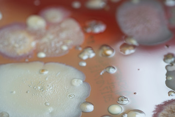 Petri dish with colonies of bacteria