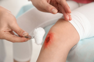 Obraz na płótnie Canvas Female doctor cleaning little girl's leg injury in clinic, closeup. First aid