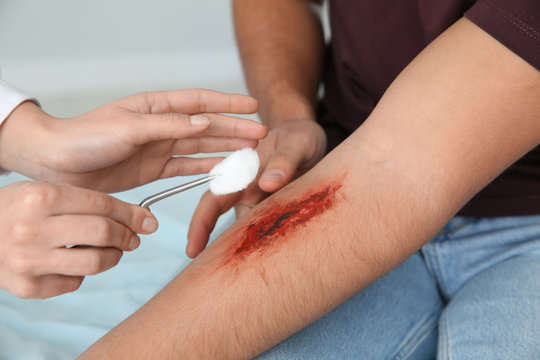 Female doctor cleaning young man's arm injury in clinic, closeup. First aid