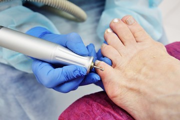 excision of calluses on the toe pedicure machine close-up