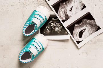 Blue booties next to baby photos with ultrasound at 4 and 20 weeks of pregnancy. The concept of awaiting baby boy, pregnancy. A son. Selective focus.