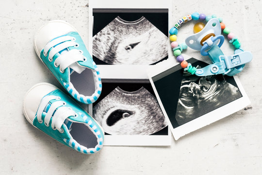 Blue booties next to baby photos with ultrasound at 4 and 20 weeks of pregnancy. The concept of awaiting baby boy, pregnancy. A son. Selective focus.