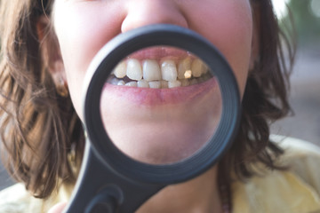 Woman with magnifier shows her crooked teeth.