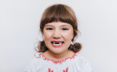 A little girl shows her milk teeth. Temporary baby teeth fall out. First-grader. Close-up.