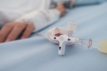 Little boy get sick from influenza need to be admitted to hospital with saline intravenous (iv) ...