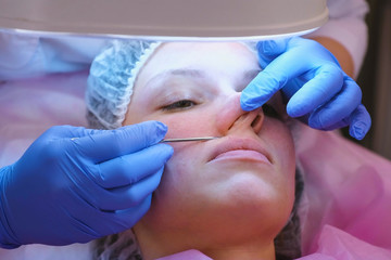 Mechanical cleaning of the face at the beautician. Cosmetologist squeeze the acne on the nose of the patient medical needle.