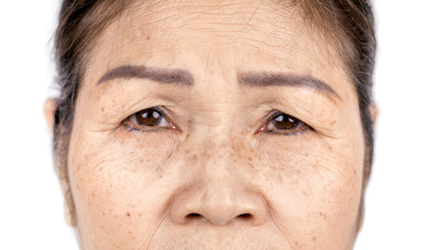 close up skin wrinkle and freckles of old asian woman face
