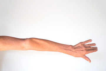 The muscles and joints of the arms of the elderly men with infla