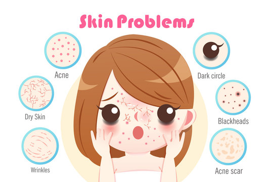 Woman With Skin Problem