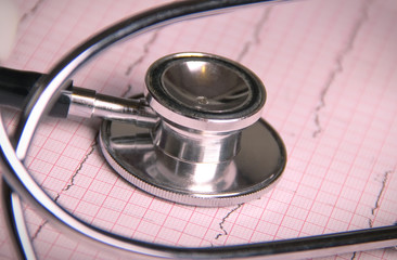 Electrocardiogram results and stethoscope
