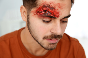 Young man with head injury in clinic. First aid © New Africa