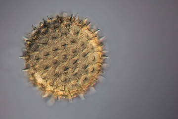 Single pollen  grain under the microscope