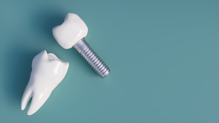 Tooth human implant - 3D Rendering - obrazy, fototapety, plakaty