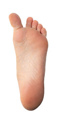 Varism on big toe of woman barefoot