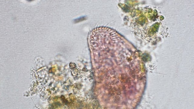 Rotifer magnification at optical microscope