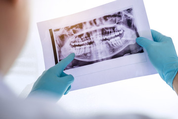 Image of male doctor or dentist holding and looking at dental x-ray - obrazy, fototapety, plakaty